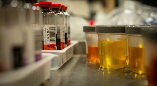 will I loose custody if I fail a drug test?
